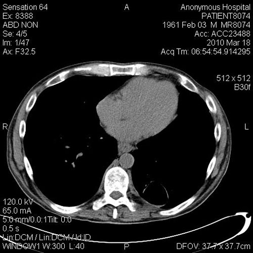 CT_abdomen_MR8074_spectra0003.jpg