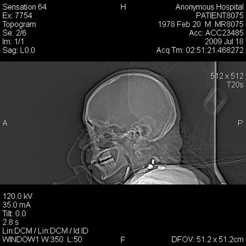 CT_brain_MR8075_spectra0002.jpg